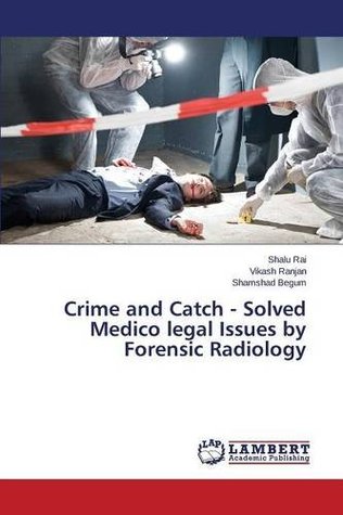 Full Download Crime and Catch - Solved Medico legal Issues by Forensic Radiology - Rai Shalu file in PDF